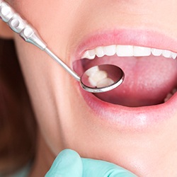Zubný kaz a príčiny jeho vzniku